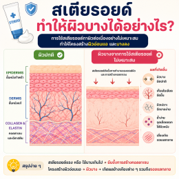 ผิวแตกลายจากครีมที่แอบผสมยาสเตอรอยด์