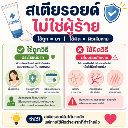 ผิวแตกลายจากครีมที่แอบผสมยาสเตอรอยด์