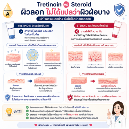 Retin-A, Retinol และกรดวิตามินเอ ต่างกันอย่างไร? ใช้รักษาสิว-ลดริ้วรอย