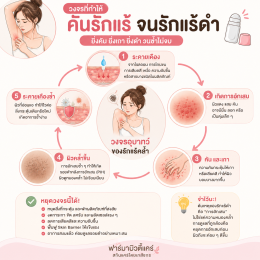 แพ้โรลออน คันรักแร้ จนรักแร้ดำ  ทำไงดี ? บทความโดยเภสัชกร
