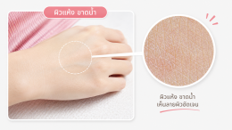 ตาข่ายผิวน้อย