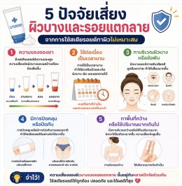 ผิวแตกลายจากครีมที่แอบผสมยาสเตอรอยด์