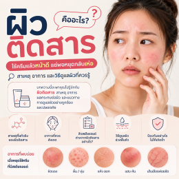 ผิวติดสารคืออะไร
