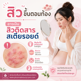 สิวในคนท้อง