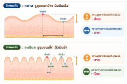 ตาข่ายผิวหาย น้อยเหลือเกิน แทบไม่มี จะเป็นไรมั้ย ต้องใช้นู่นนี่ตามที่พนักงานขายบอกหรือเปล่า แล้วแก้ไขยังไงดี