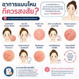 ผิวติดสารคืออะไร