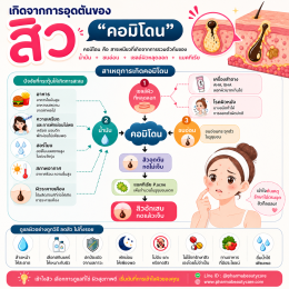ประเภทสิว สิวมีกี่ประเภท สิวอุดตัน สิวอักเสบ สิวผด  บทความโดยเภสัชกร