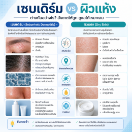 เซบเดิร์ม (Seborrheic Dermatitis) คืออะไร? สาเหตุ อาการ และวิธีรักษา  บทความโดยเภสัชกร 