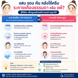 ผิวแพ้ง่าย ใช้ครีมอะไรดี? บทความโดยเภสัชกร