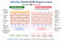 ผิวขาดน้ำ ผิวมันขาดน้ำ คืออะไร เกิดจากอะไร แก้ไขอย่างไรดี