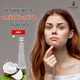 น้ำมันมะพร้าวสกัดเย็นลดสิวได้ผลดีนัก