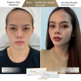 Review Filler ปรับรูปหน้า