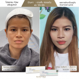 Review Filler ปรับรูปหน้า