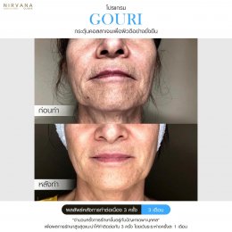 Gouri Collagen PCL 21% สร้างคอลลาเจนอย่างยั่งยืน เปลี่ยนผิวเก่าเป็นผิวใหม่