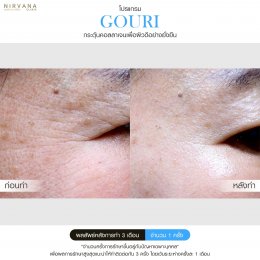 Gouri Collagen PCL 21% สร้างคอลลาเจนอย่างยั่งยืน เปลี่ยนผิวเก่าเป็นผิวใหม่