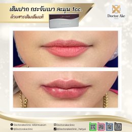 Filler ใต้ตา