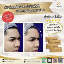 Filler หน้าผาก