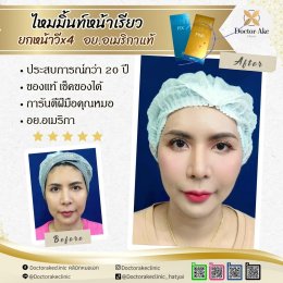 ร้อยไหม Premium Mint Lift