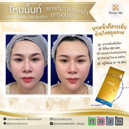 ร้อยไหม Premium Mint Lift