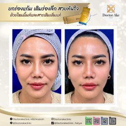 ร้อยไหม Premium Mint Lift