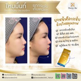 ร้อยไหม Premium Mint Lift