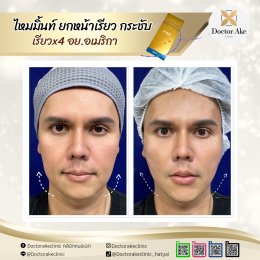 ร้อยไหม Premium Mint Lift