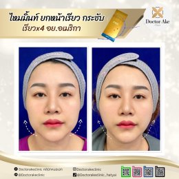 ร้อยไหม Premium Mint Lift