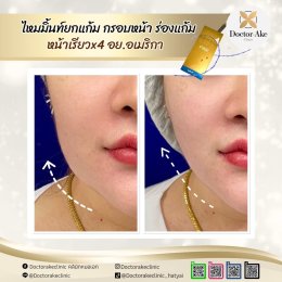 ร้อยไหม Premium Mint Lift