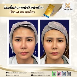 ร้อยไหม Premium Mint Lift