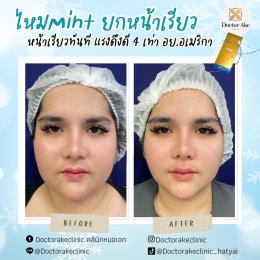 ร้อยไหม Premium Mint Lift