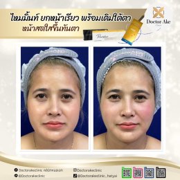 ร้อยไหม Premium Mint Lift