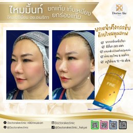 ร้อยไหม Premium Mint Lift