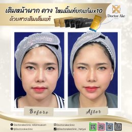 ร้อยไหม Premium Mint Lift