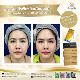 ร้อยไหม Premium Mint Lift