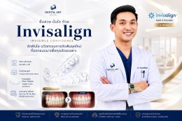 เคสจัดฟันใส Invisalign ก่อนและหลัง | Dental Art Elite