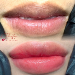 5. สักปากสุขภาพดี V-Fuffy Lips