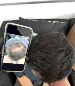 เรียนสเก้าเพ้นติ้ง Scalp Painting หลักสูตร 1 วัน