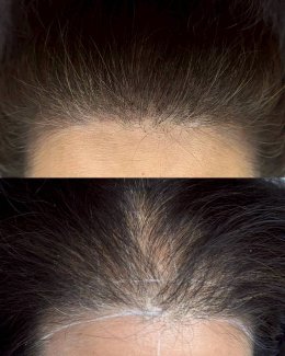 เรียนสเก้าเพ้นติ้ง Scalp Painting หลักสูตร 1 วัน