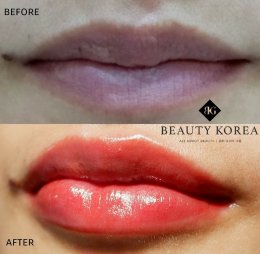 6. สักปากชมพูสไตล์เกาหลี Korea Perfect Lips