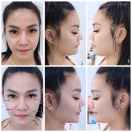 หลักสูตรเกาหลีนวดหน้ายกกระชับ 3วัน