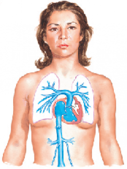 PULMONARY HYPERTENSION