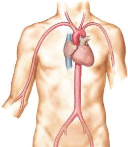 Percutaneous Coronary Intervention