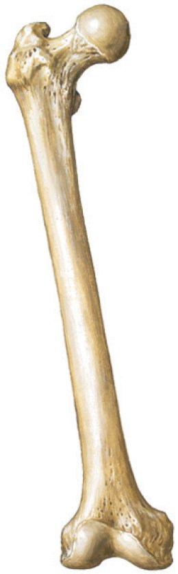 Pagets disease of bone