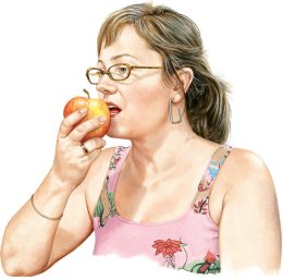 Gluten-free diet