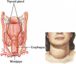 Hyperthyroidism 