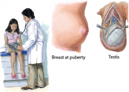 Delayed Puberty 