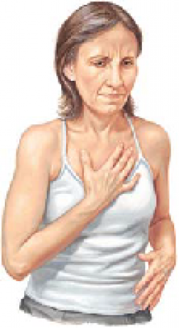 Costochondritis 