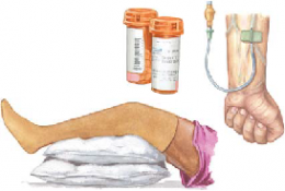 Pulmonary Embolism 