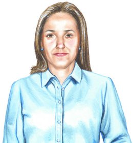 Scleroderma