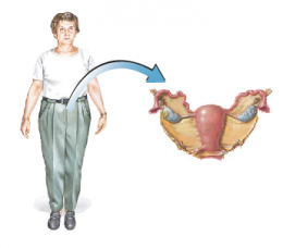 Endometrial Cancer 